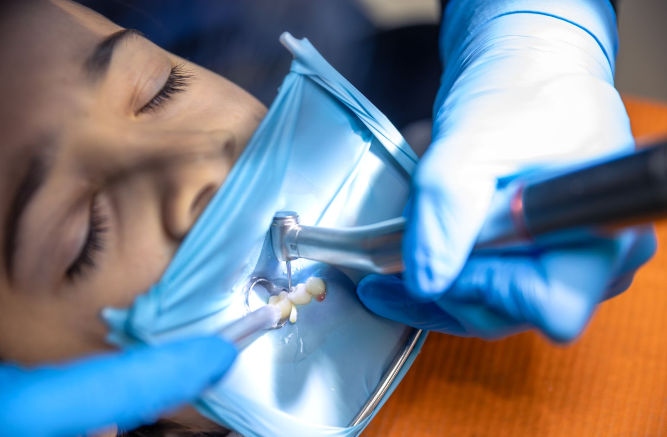 A tooth being treated with a rubber dam protecting the surrounding area.